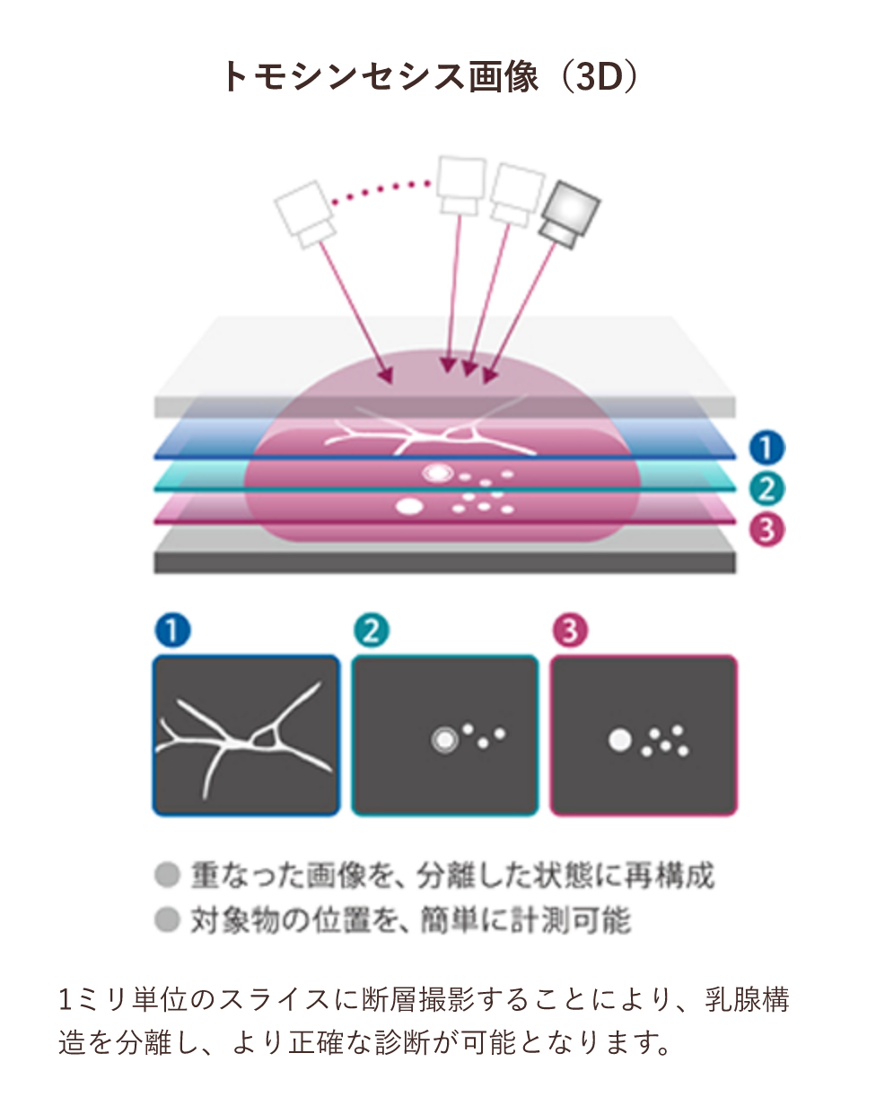 トモシンセシス画像（3D）